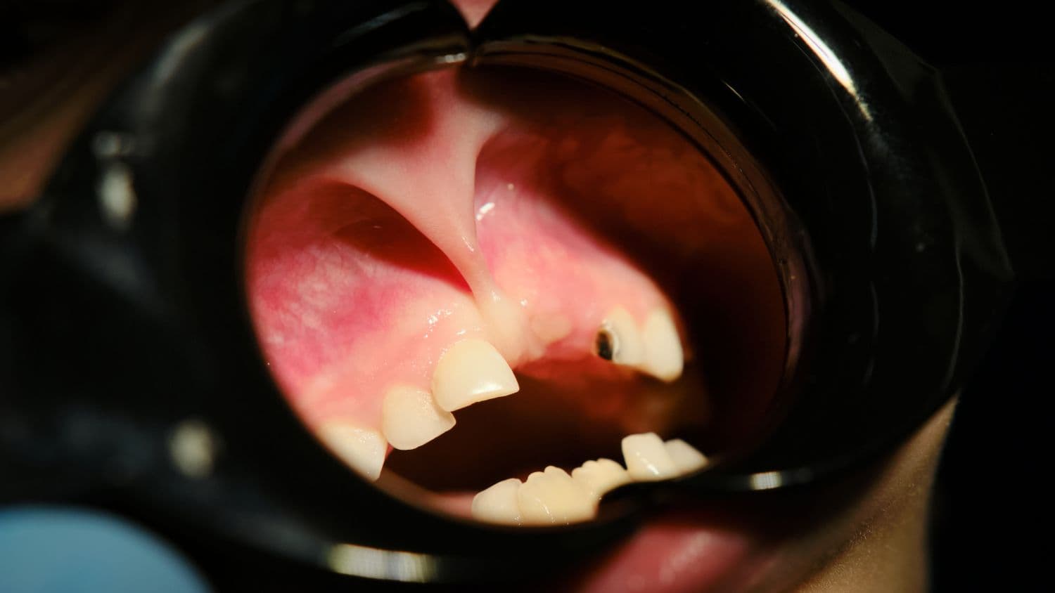 Oral surgery gallery from Aura Clinic - Aura Clinic Vlora