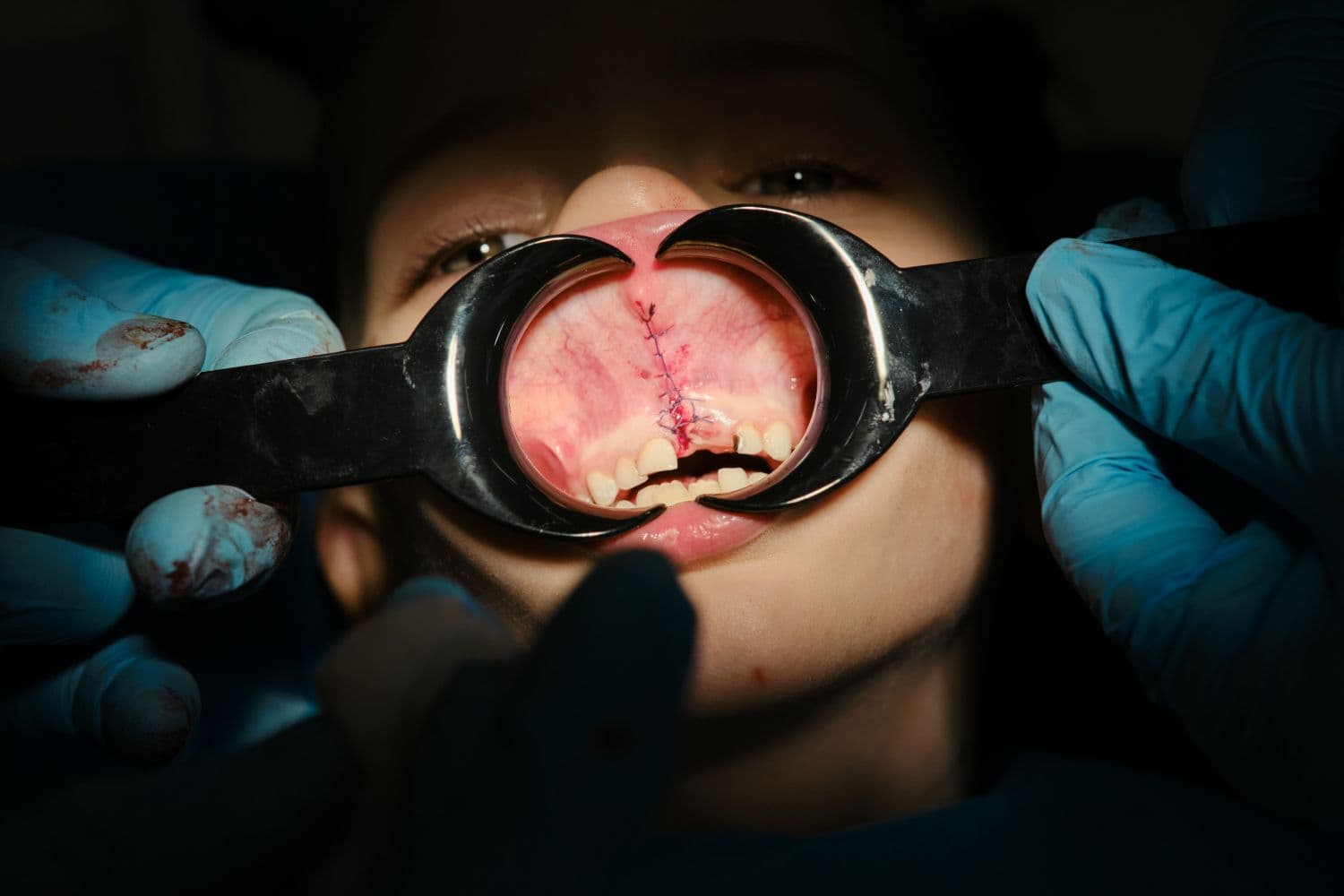 Oral surgery gallery from Aura Clinic - Aura Clinic Vlora
