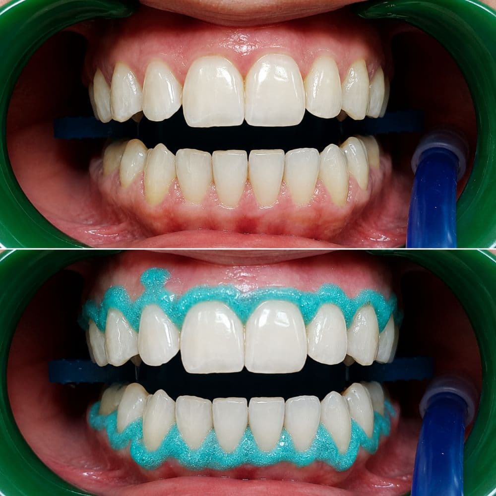 Galeria e endodontisë nga Aura Clinic - Aura Clinic Vlora