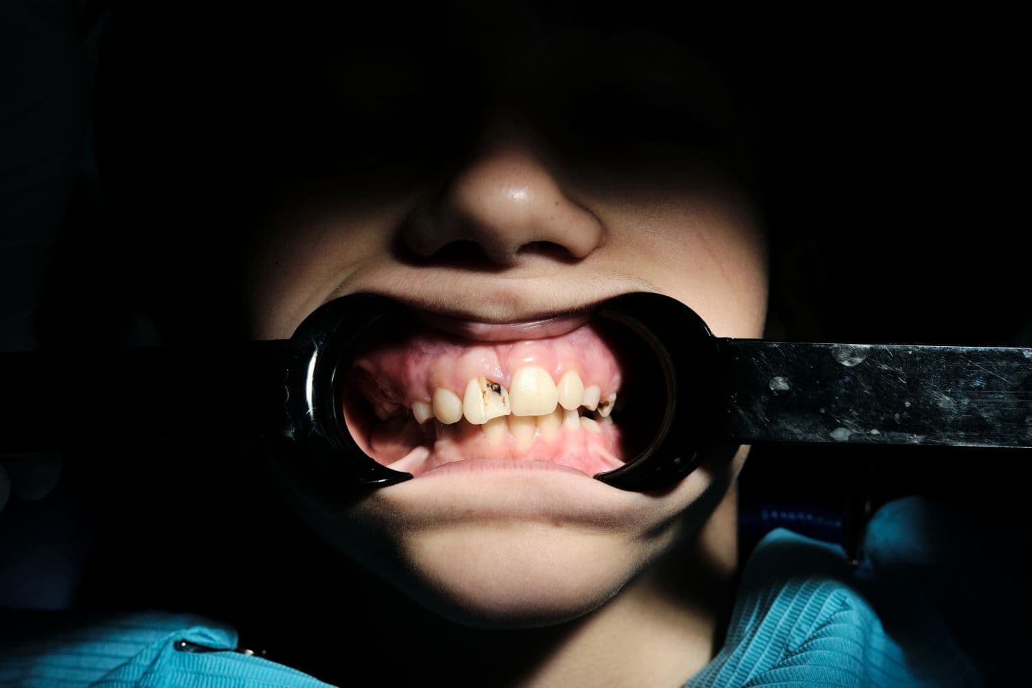 Dentist pediatrik në Vlorë Shqipëri në Aura Clinic