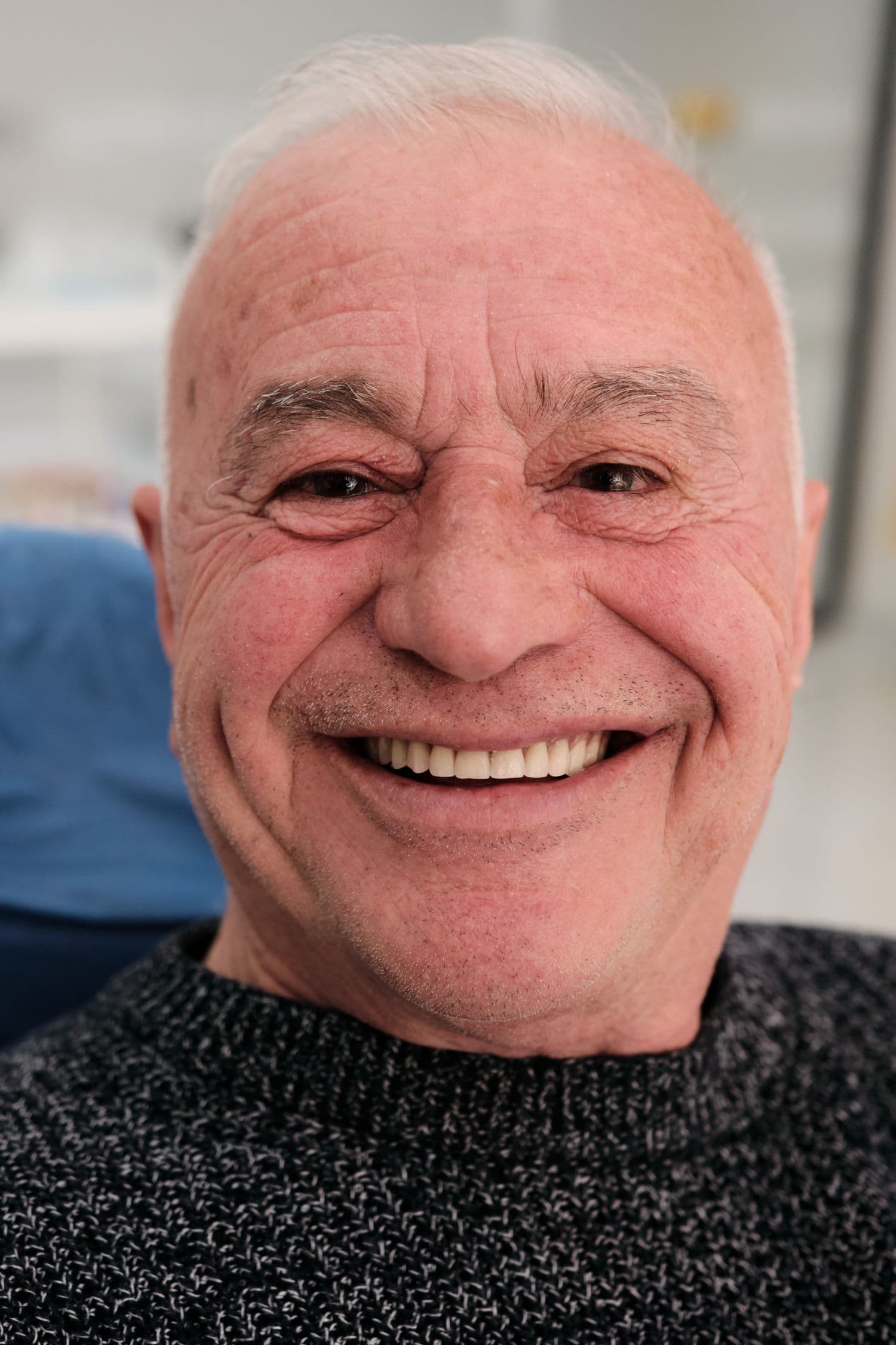Smile Makeover në Shqipëri në Aura Clinic Vlorë me planifikim buzëqeshjeje modern